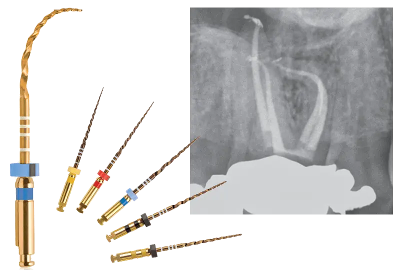 ニッケルチタンファイル
