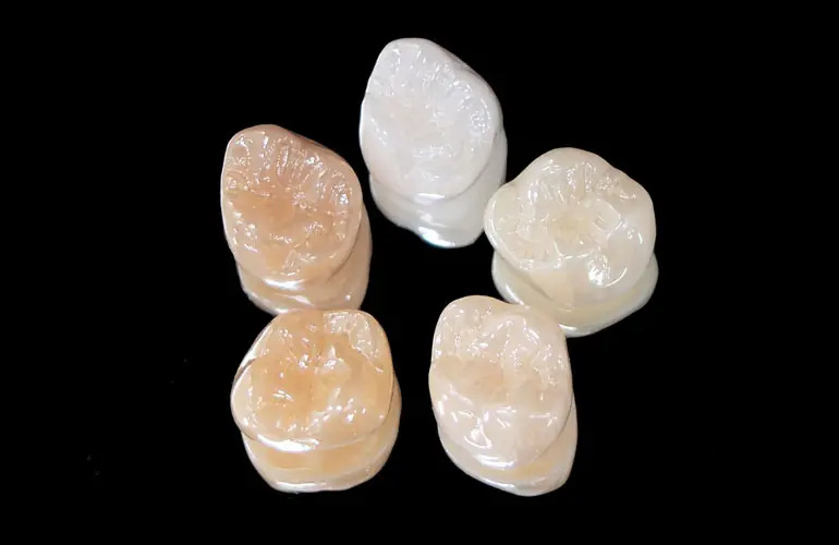 セラミック治療