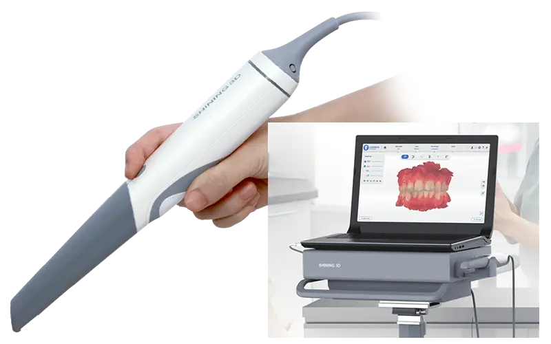 口腔内スキャナー