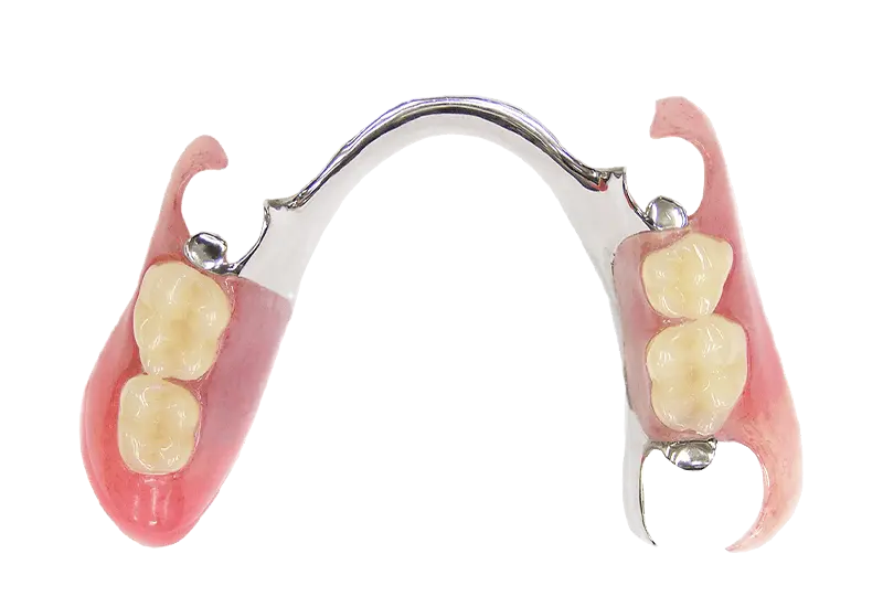 部分入れ歯（部分義歯）