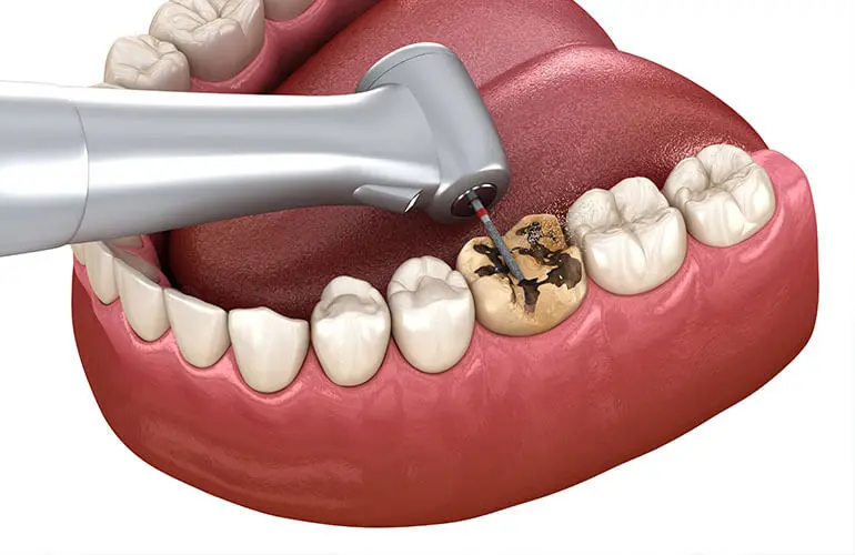 診察と治療計画