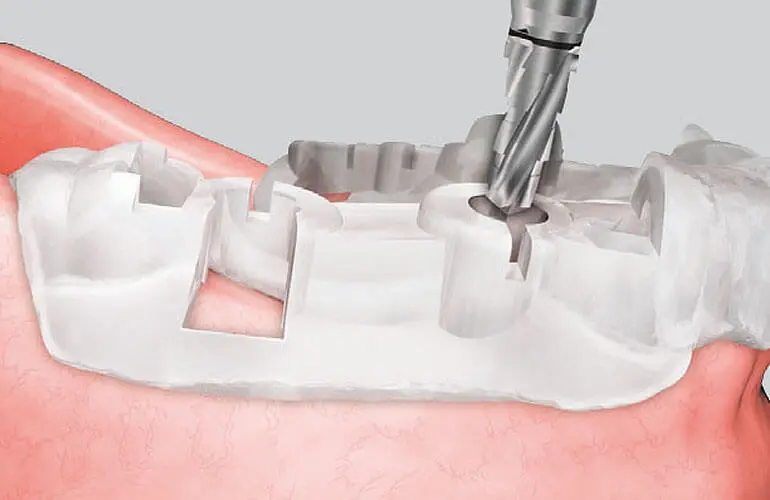 診察と治療計画