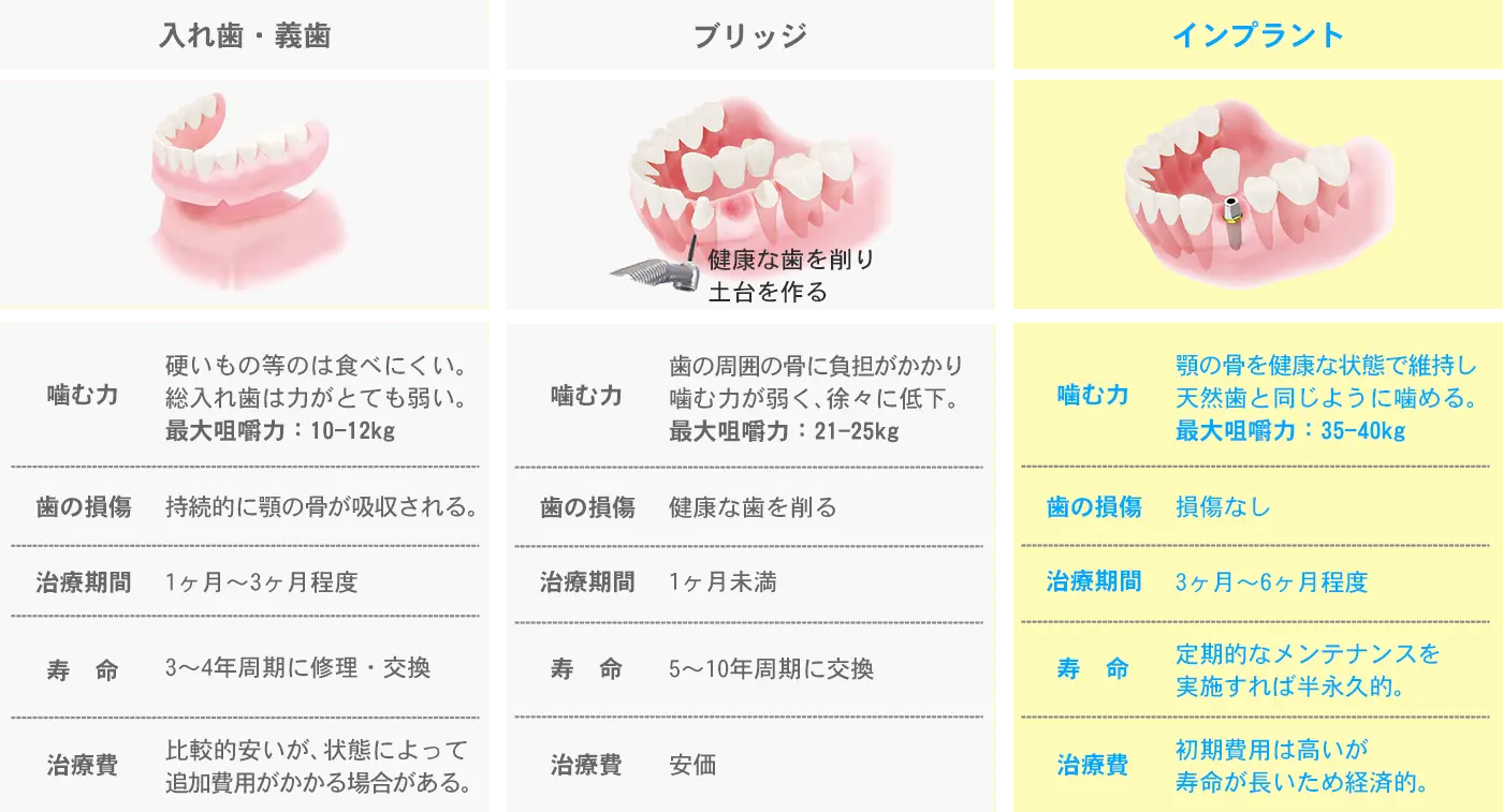 インプラント・ブリッジ・入れ歯（義歯）