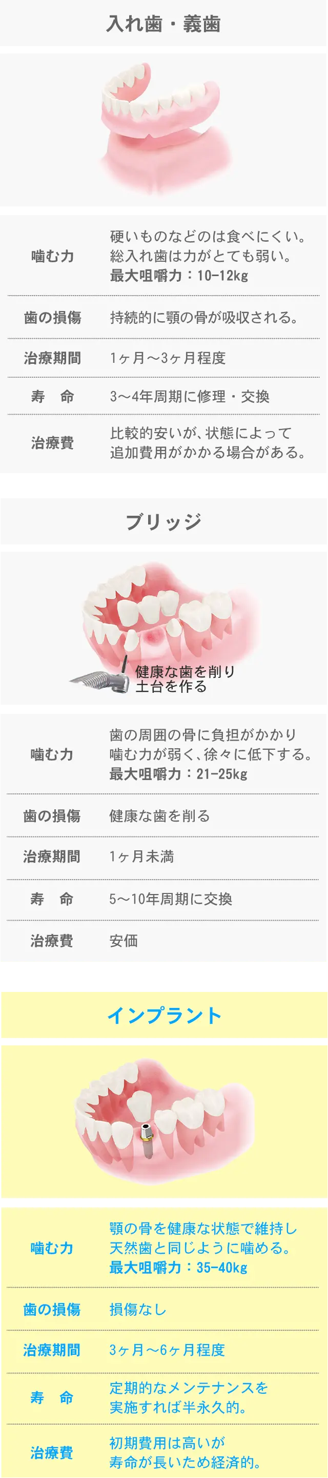 インプラント・ブリッジ・入れ歯（義歯）