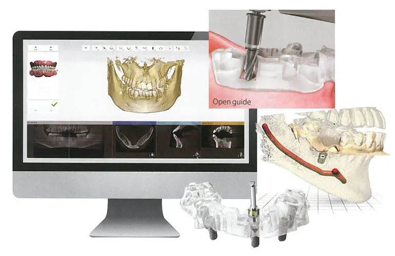 ガイドシステム