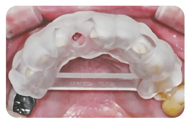 手術を簡単かつ正確に！