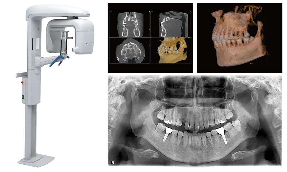 歯科用CT・デジタルレントゲン