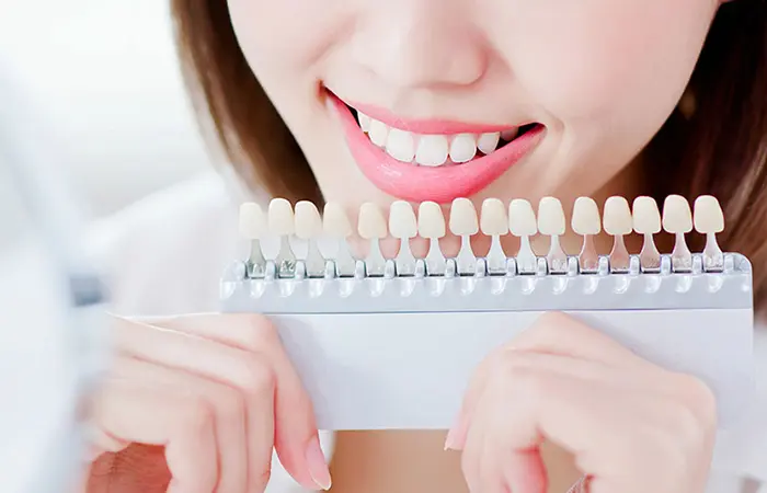 ホワイトニング